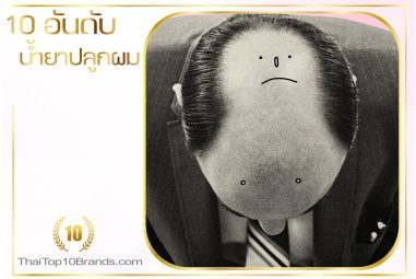 10 อันดับผลิตภัณฑ์แก้อาการผมร่วงที่ดีที่สุด